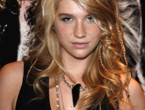 Kesha plastic surgery 20