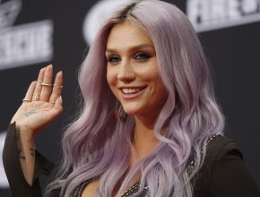 Kesha plastic surgery 23