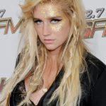 Kesha plastic surgery 28