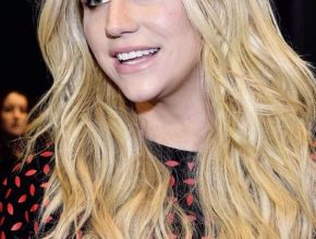 Kesha plastic surgery 3