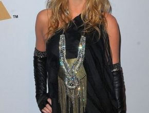 Kesha plastic surgery 33