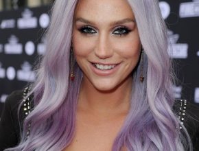 Kesha plastic surgery 34