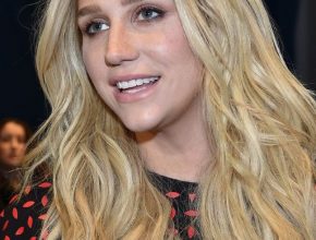 Kesha plastic surgery 36