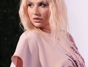 Kesha plastic surgery 40