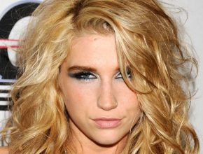 Kesha plastic surgery 5