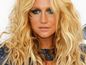 Kesha plastic surgery 8