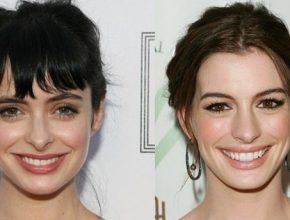 Krysten Ritter before and after plastic surgery 11