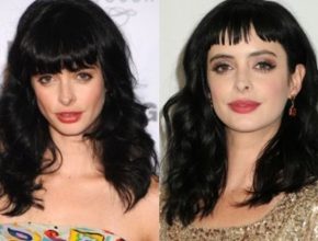 Krysten Ritter before and after plastic surgery