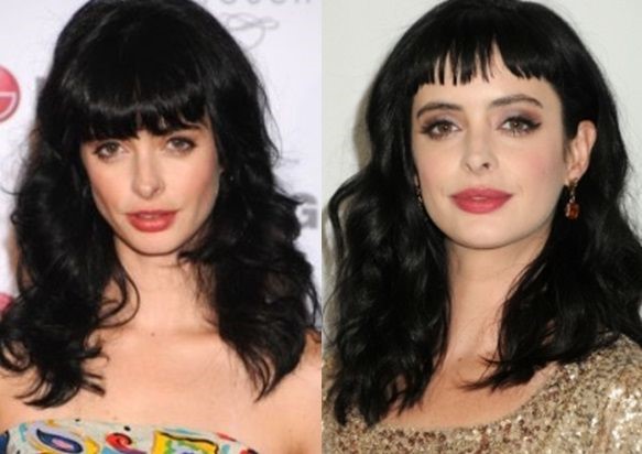 Krysten Ritter before and after plastic surgery