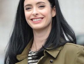 Krysten Ritter plastic surgery 10