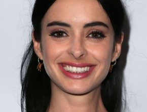 Krysten Ritter plastic surgery 14