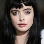 Krysten Ritter Plastic Surgery 25