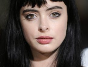 Krysten Ritter Plastic Surgery 25