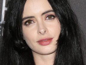 Krysten Ritter plastic surgery