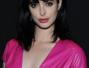 Krysten Ritter Plastic Surgery 32