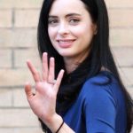 Krysten Ritter plastic surgery 8