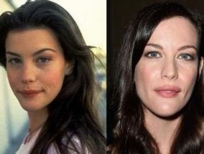 Liv Tyler before and after plastic surgery 26