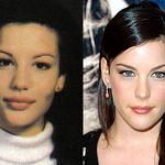 Liv Tyler before and after plastic surgery