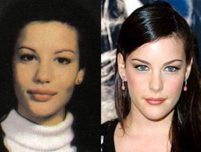 Liv Tyler before and after plastic surgery