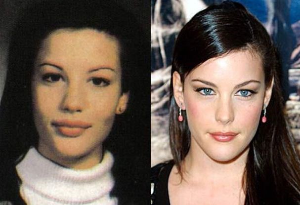 Liv Tyler before and after plastic surgery