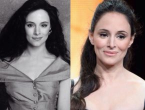 Madeleine Stowe before and after plastic surgery