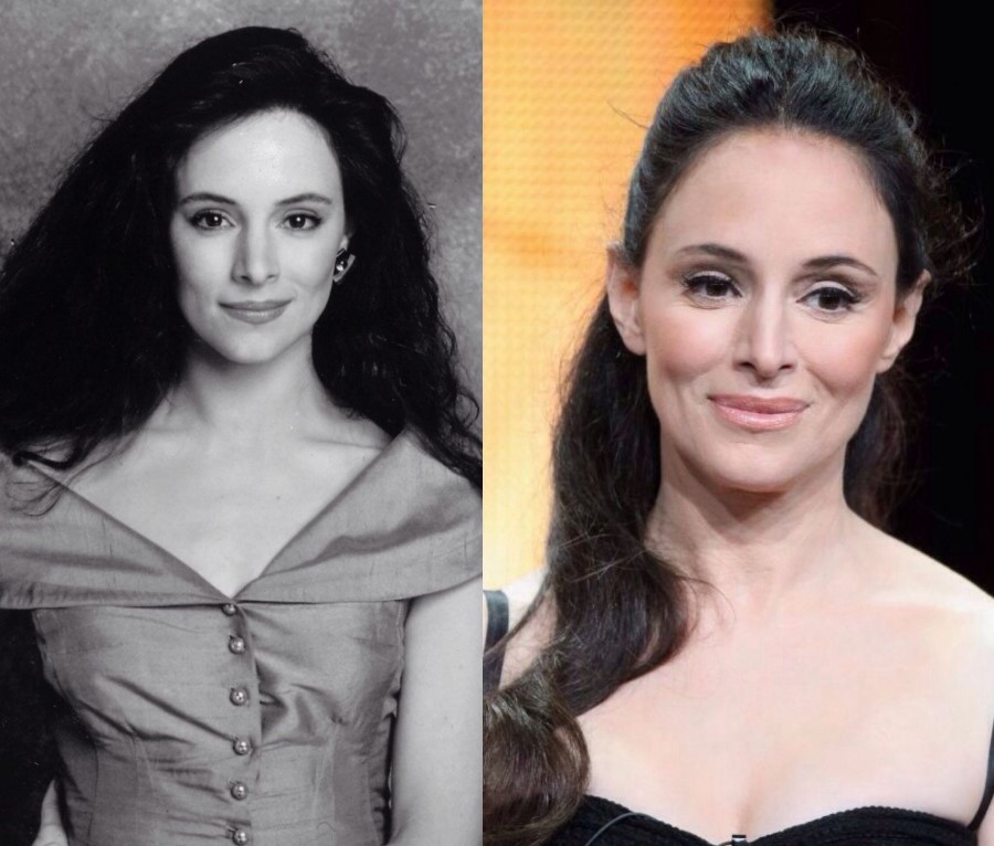 Madeleine Stowe before and after plastic surgery