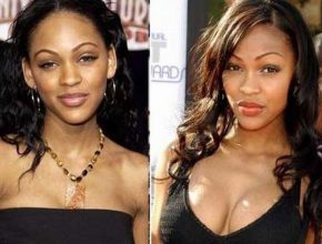 Meagan Good before and after plastic surgery 8