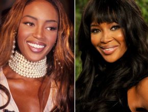 Naomi Campbell before and after plastic surgery