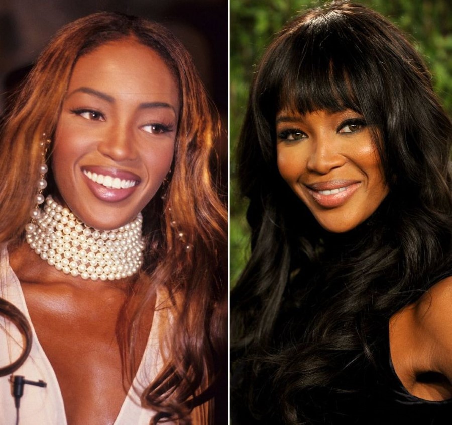 Naomi Campbell before and after plastic surgery