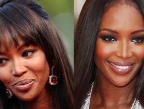 Naomi Campbell before and after plastic surgery 6