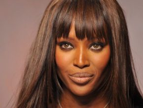 Naomi Campbell plastic surgery 10