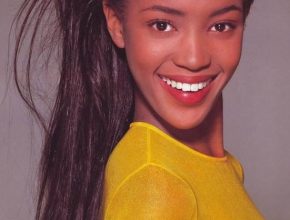 Naomi Campbell plastic surgery 14