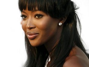 Naomi Campbell plastic surgery 3