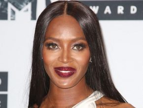 Naomi Campbell plastic surgery 31