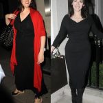 Nigella Lawson before and after plastic surgery 1