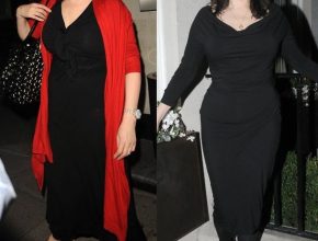 Nigella Lawson before and after plastic surgery 1