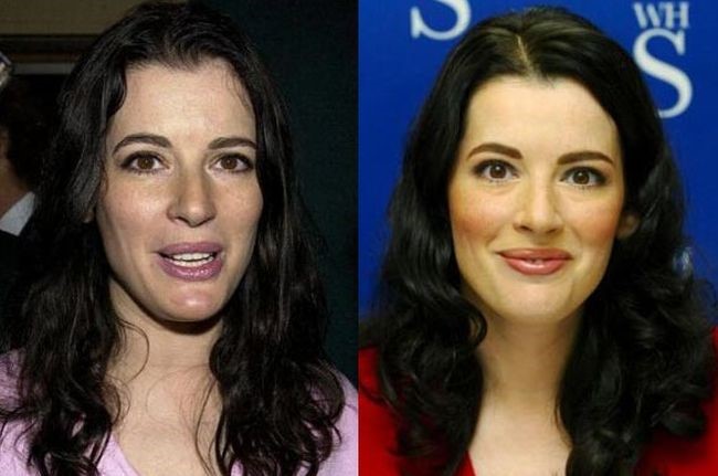 Nigella Lawson before and after plastic surgery 