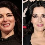 Nigella Lawson before and after plastic surgery 58