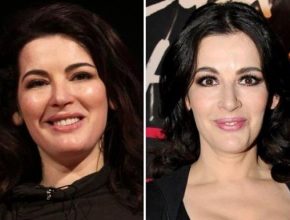 Nigella Lawson before and after plastic surgery 58