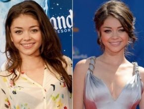 Sarah Hyland before and after plastic surgery