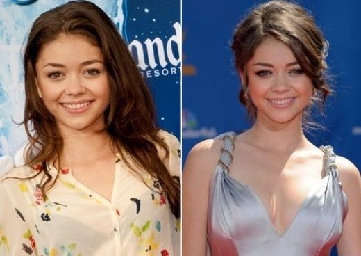 Sarah Hyland before and after plastic surgery