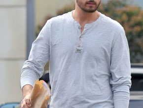 Scott Disick plastic surgery 27