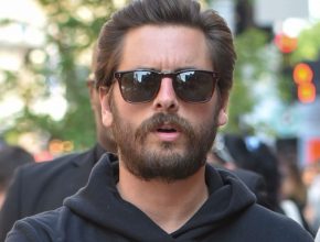 Scott Disick plastic surgery 28