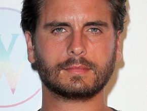 Scott Disick plastic surgery 36