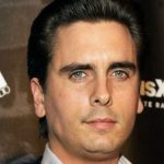 Scott Disick plastic surgery 5