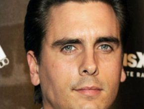 Scott Disick plastic surgery 5