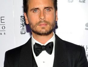 Scott Disick plastic surgery 8