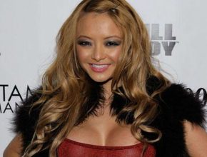 Tila Tequila plastic surgery 01