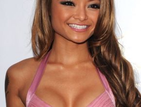 Tila Tequila plastic surgery