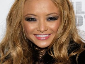 Tila Tequila plastic surgery 8